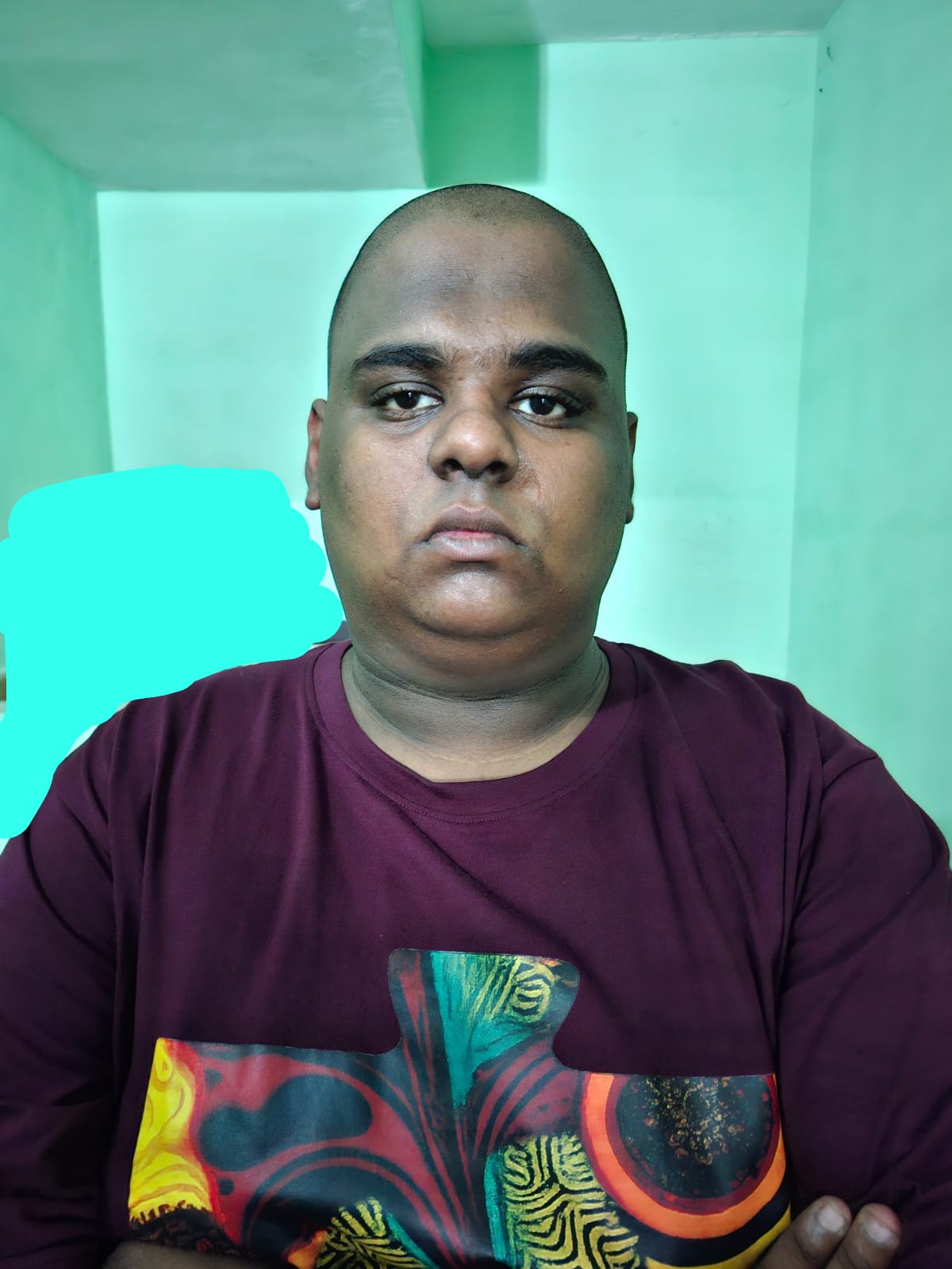 மருத்துவமனையில் அனுமதிக்கப் பட்டிருந்த ஆந்திராவைச் சேர்ந்த கைதி தப்பி ஓட்டம்..,